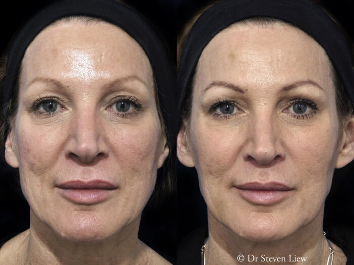 Total Face Enhancement - Shape Clinic